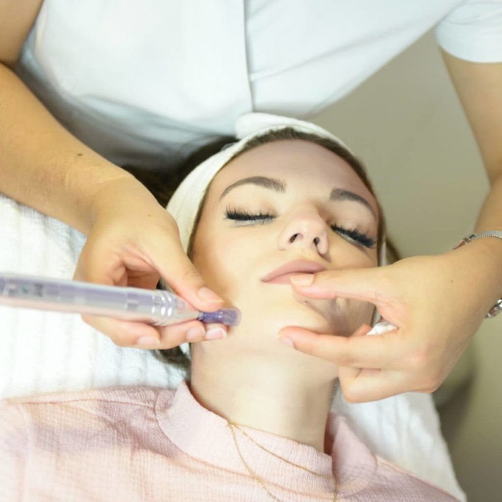 Primer plano de un tratamiento Dermapen, donde se usa un dispositivo para aplicar microagujas en el rostro de una mujer.