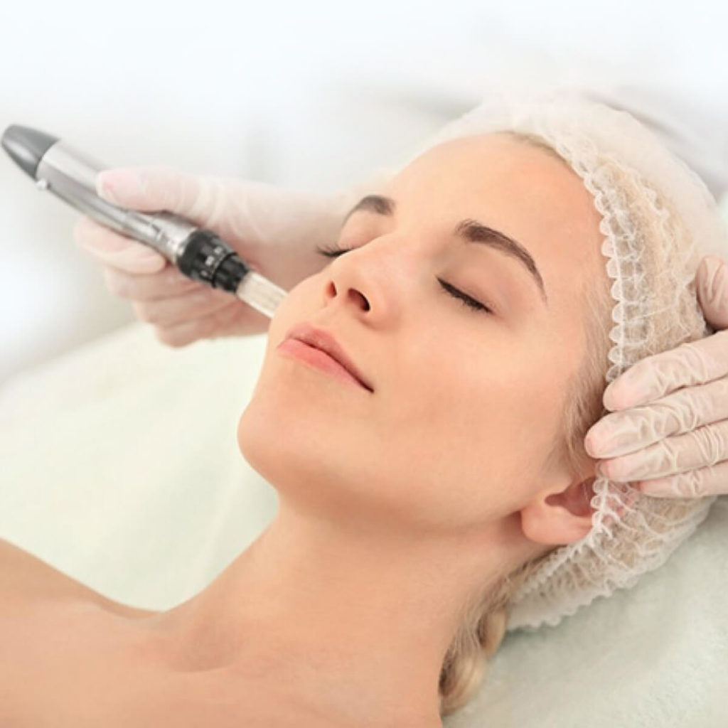 Primer plano de un tratamiento Dermapen