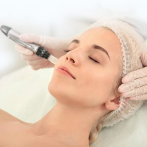 Tratamiento Facial con Dermapen en Alcobendas Tratamiento facial con Dermapen en nuestro centro de estética en Alcobendas.