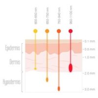 Diagrama de penetración de tratamientos según profundidad de la piel