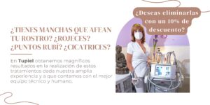 Tienes manchas que afectan tu rostro?