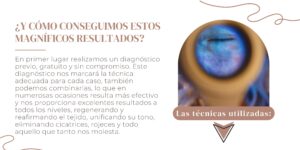 ¿Y como conseguimos estos magníficos resultados?
