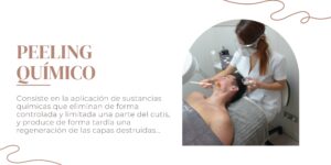 Peeling Químico