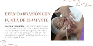 Dermoabrasión con punta de diamante