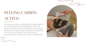 Peeling Carbón Activo