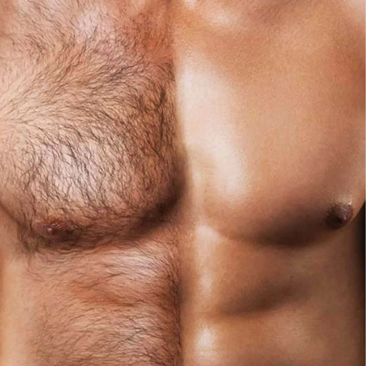Pecho masculino antes y después de una sesión de depilación láser