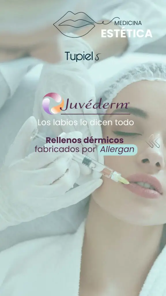 Tratamiento de relleno dérmico con Juvéderm en los labios realizado en Estética Tupiel.
