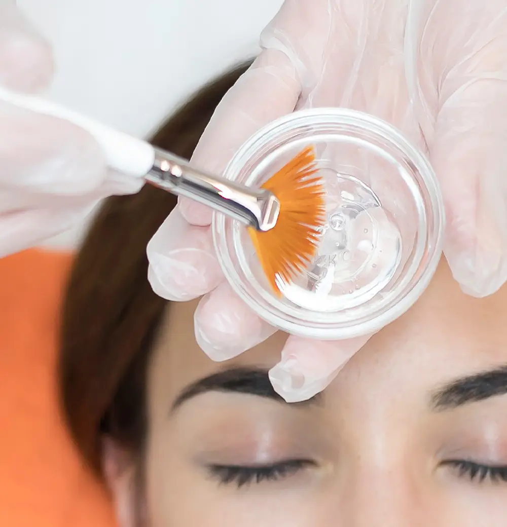 Aplicación de peeling facial profesional con productos Medi+Derma