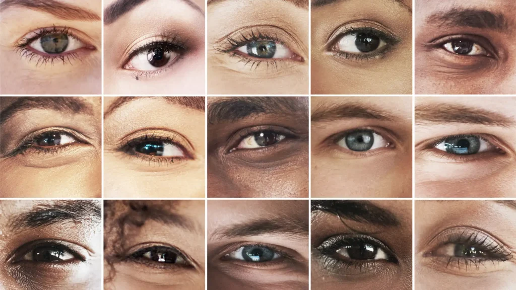 Collage de primeros planos de ojos de personas con distintos tonos de piel, mostrando ojeras y bolsas como ejemplo de tratamientos estéticos sin cirugía.
